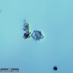 Hypotrichia