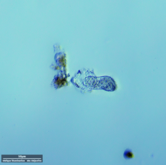 Hypotrichia