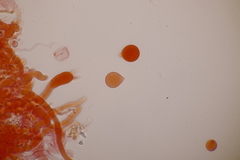 Laetisaria lichenicola