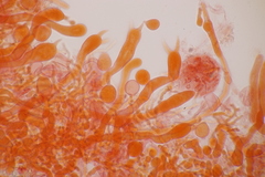 Laetisaria lichenicola