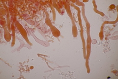 Laetisaria lichenicola