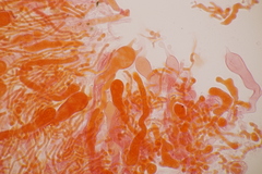 Laetisaria lichenicola