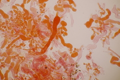 Laetisaria lichenicola