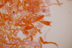 Laetisaria lichenicola