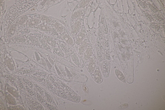 Pseudomassaria sepincoliformis