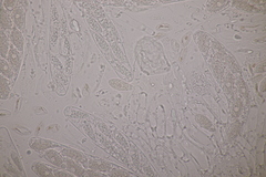 Pseudomassaria sepincoliformis