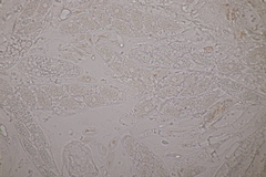 Pseudomassaria sepincoliformis