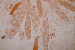 Pseudomassaria sepincoliformis