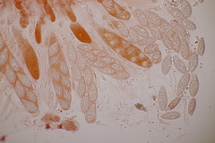 Pseudomassaria sepincoliformis