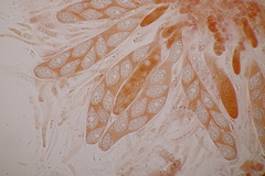 Pseudomassaria sepincoliformis