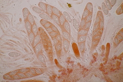 Pseudomassaria sepincoliformis