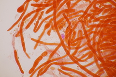 Laetisaria fuciformis