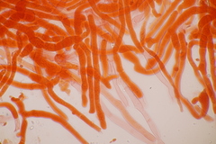 Laetisaria fuciformis