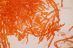 Laetisaria fuciformis