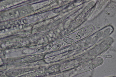 Peziza griseorosea