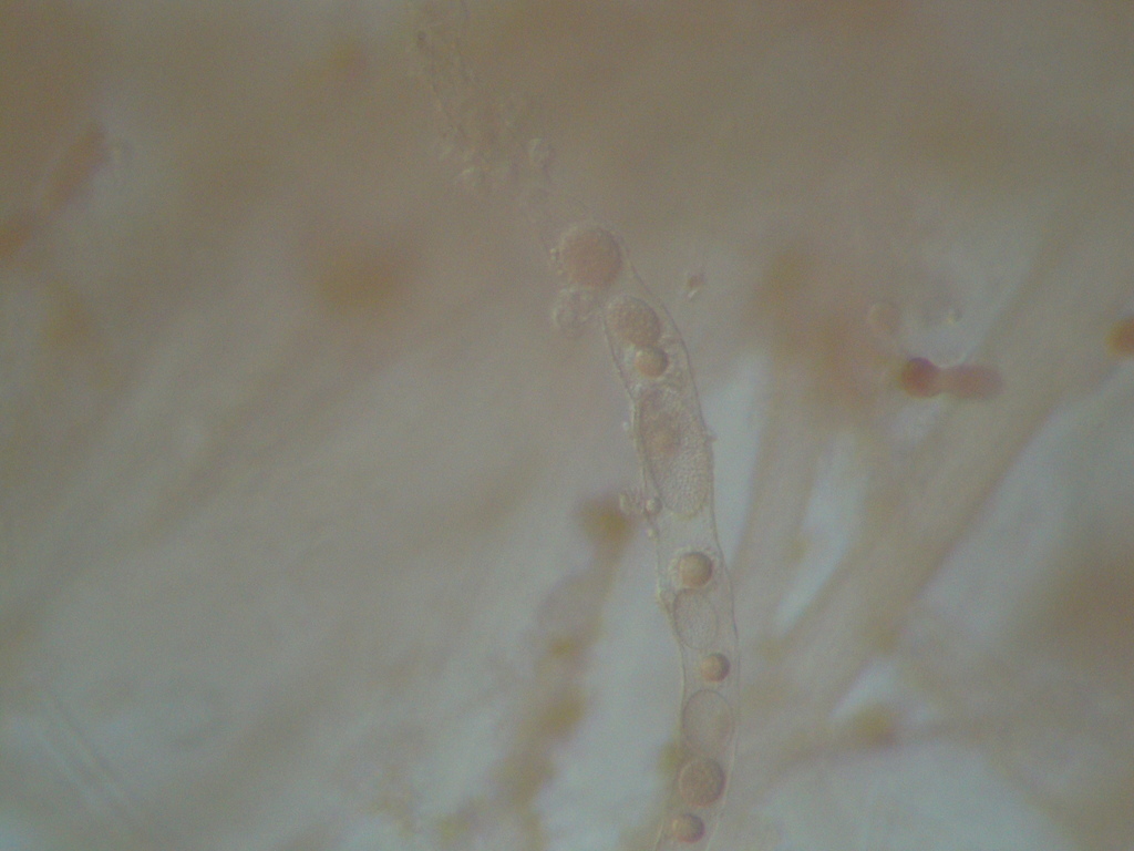 Olpidiopsidaceae