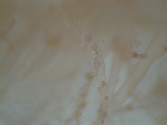 Olpidiopsis varians
