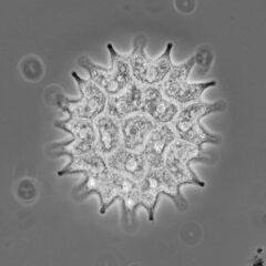 Pseudopediastrum boryanum