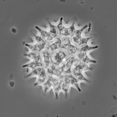 Pseudopediastrum boryanum