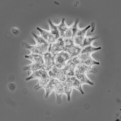 Pseudopediastrum boryanum