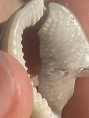 Semicassis granulata