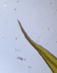 Didymodon icmadophilus
