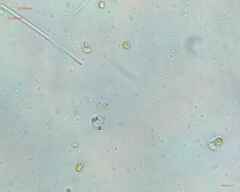 Synechocystis