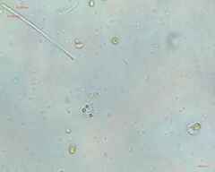 Synechocystis