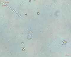 Synechocystis