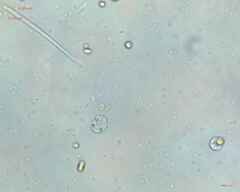 Synechocystis