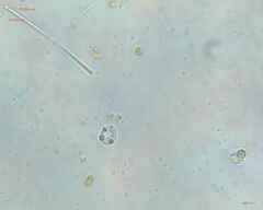 Synechocystis