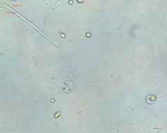 Synechocystis