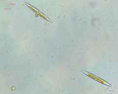 Chytridiomycota