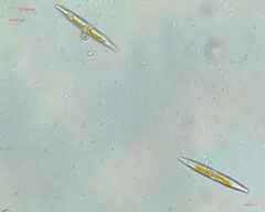 Chytridiomycota