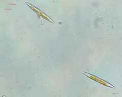 Chytridiomycota