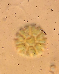 Hydrodictyaceae