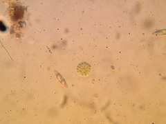 Hydrodictyaceae
