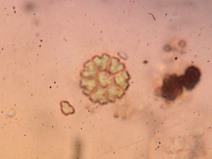 Hydrodictyaceae