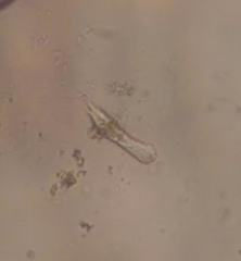 Gastrotricha