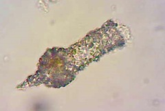 Tintinnopsis