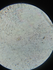 Cocconeis placentula