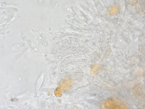 Hamatocanthoscypha image