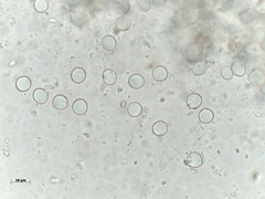 Orbicula parietina image