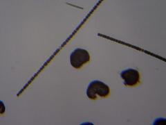 Dolichospermum planctonicum