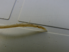 Ascaris lumbricoides