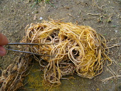 Ascaris lumbricoides