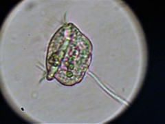 Vorticella
