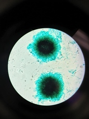 Gloeotrichia echinulata