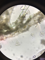 Vorticella campanula