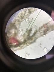 Vorticella campanula